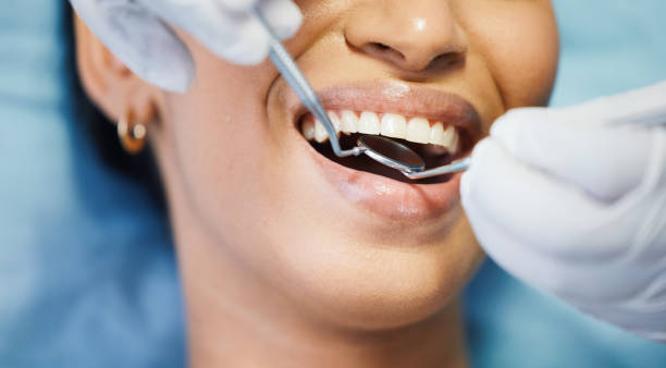 Best Emergency Tooth Extraction in Woodinville, WA